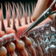 Hair Treatment Myths: Discover the Truth Behind Them