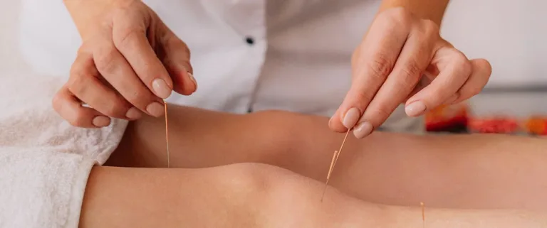 Acupuncture: Your Complete Guide to Stress and Anxiety Relief